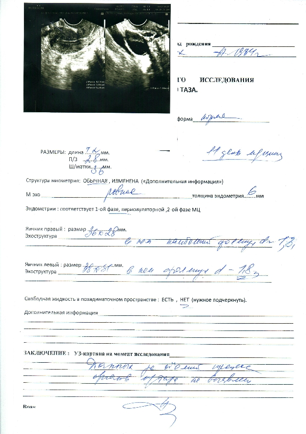 «Без названия»
